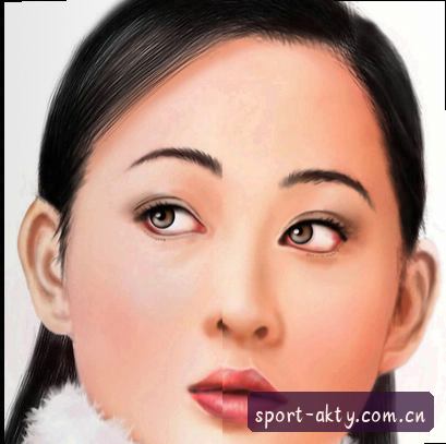 陈宇